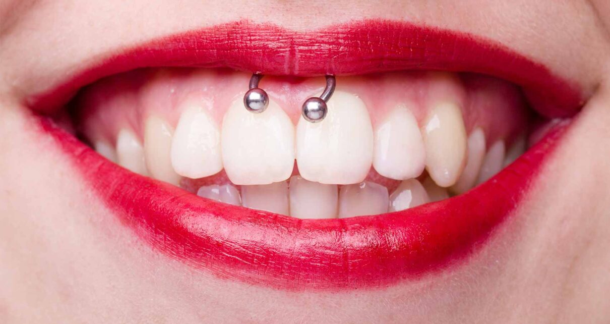 Smiley Piercing